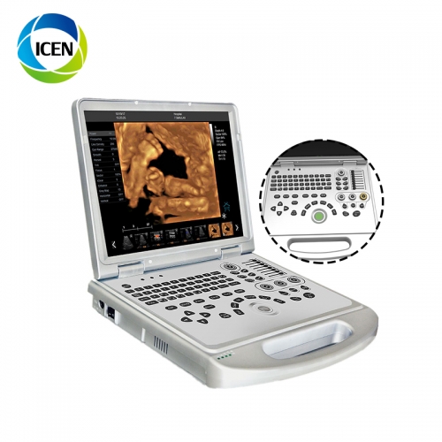 IN-AC60PLUS 3D 4D 5D Portable Notebook/Laptop Dopler Echo Wed ...